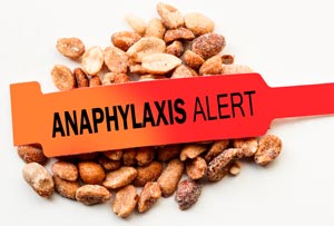 Peanuts on a Ketogenic Diet: Eat or Avoid?