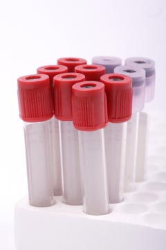 High Cholesterol on a Keto Diet - Should You Be Concerned?
